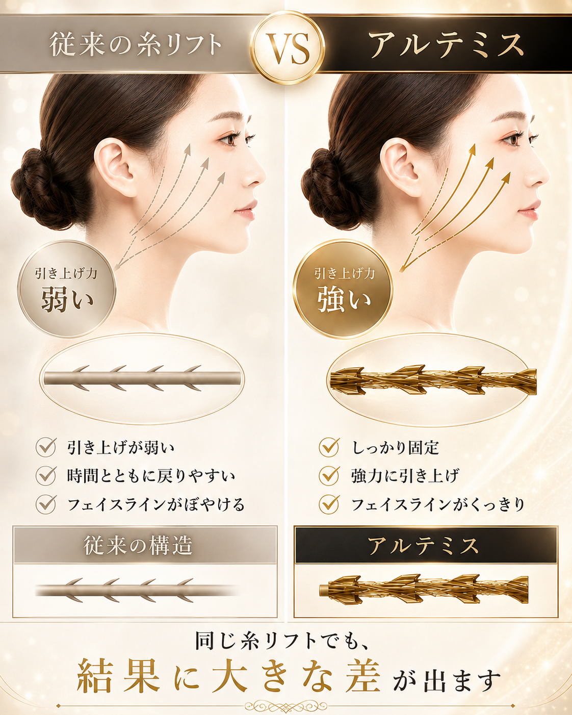 アルテミスリフト 従来の糸リフトとの比較
